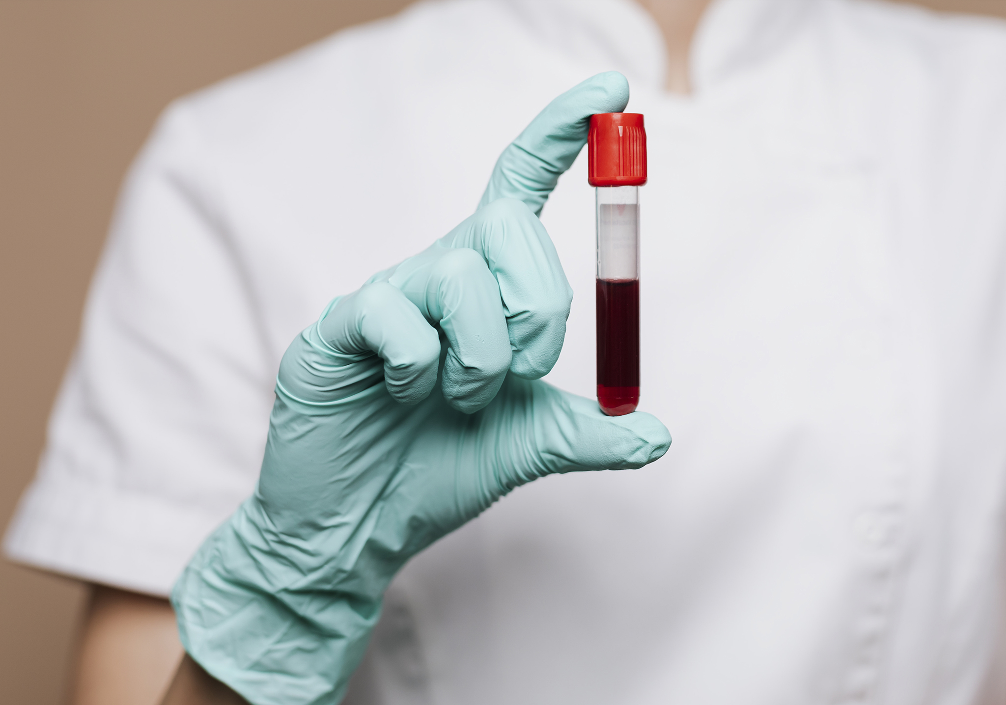 Hematology Vivamed Health